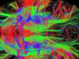 Downtown Uptown Northshore Neuroscience Krewe DUNNK (December): Mostany Lab illustration